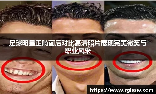足球明星正畸前后对比高清照片展现完美微笑与职业风采